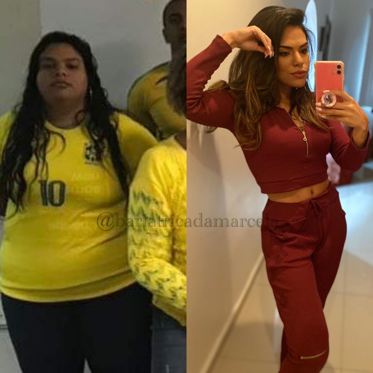 Antes e Depois: Marcela